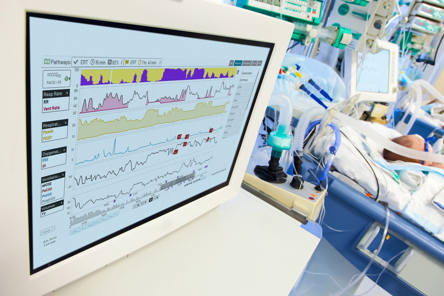 The Etiometry platform continuously ingests patient data and streams algorithms to detect patient deterioration, providing the ability to look deeply into all patient physiologies to facilitate proactive and individualized care escalation and de-escalation.