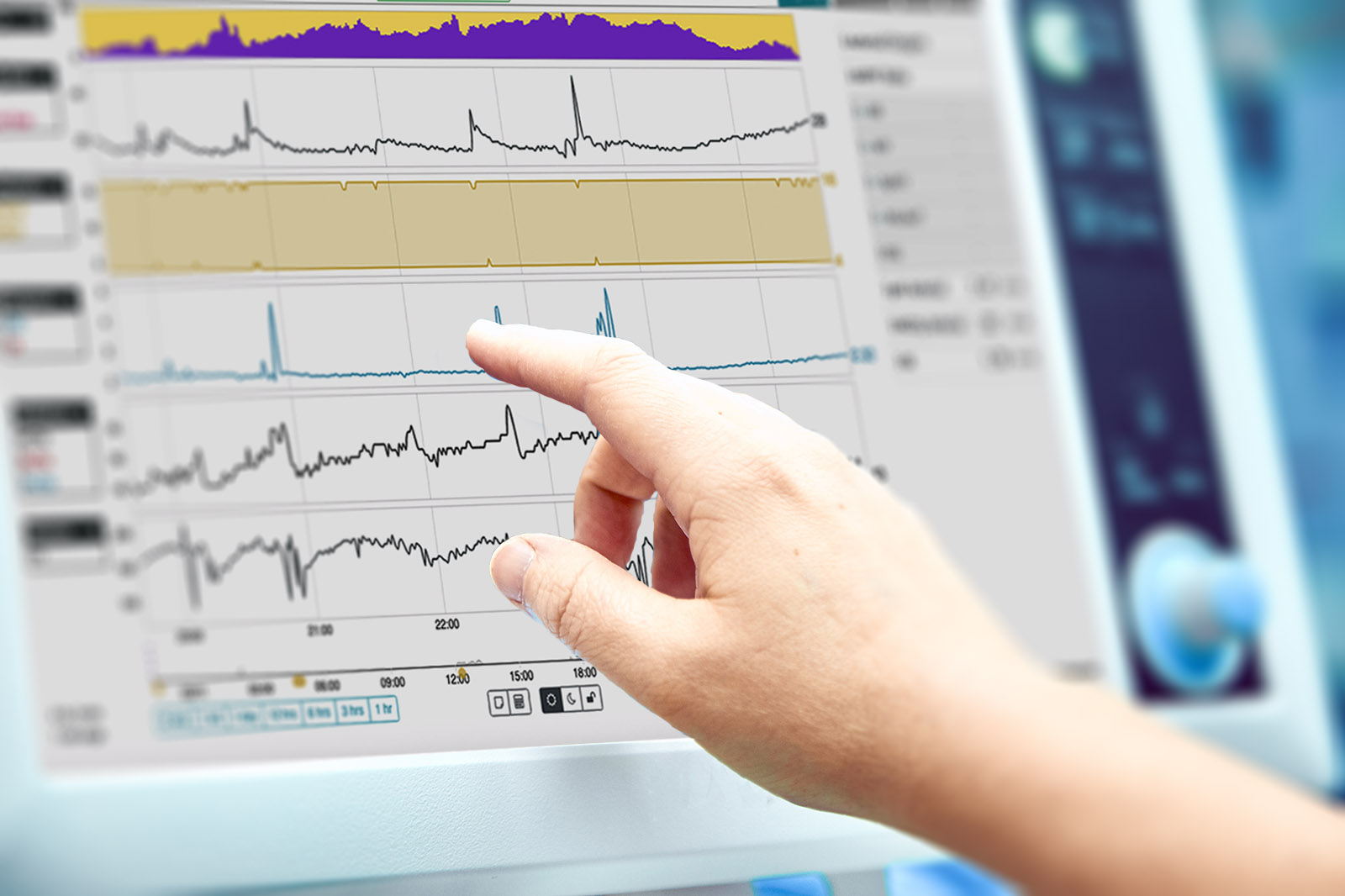 Monitoring patient's vital sign in operating room. doctor cheking at patient's vital signs. Cardiogram monitor during surgery in operation room.